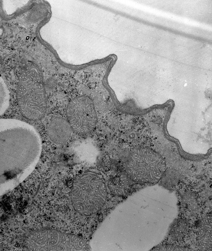 CIL:38895, Paramecium caudatum, cell by organism, eukaryotic cell, Eukaryotic Protist, Ciliated Protist