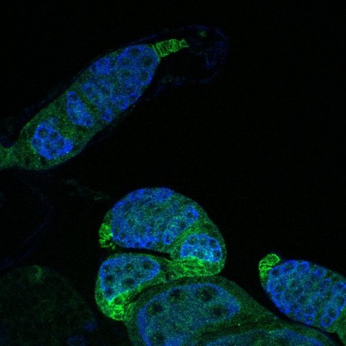 CIL:13739, Drosophila melanogaster, germ line cell, follicle cell, germ line stem cell, follicle stem cell