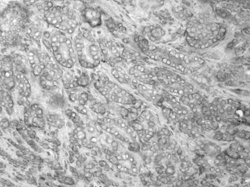 CIL:33606, Homo sapiens, endocrine-paracrine cell of prostate gland, basal cell of prostate epithelium, luminal cell of prostate epithelium, blood vessel endothelial cell, perineural cell, sheath cell, leukocyte, prostate stromal cell, smooth muscle cell of prostate