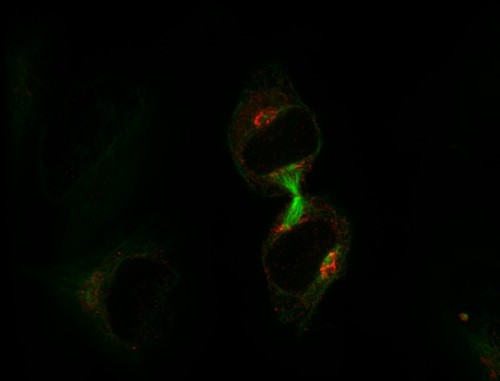 CIL:7224, Homo sapiens, epithelial cell