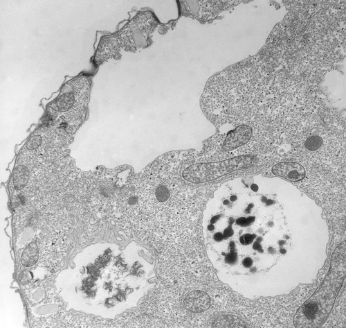 CIL:39799, Tetrahymena pyriformis, cell by organism, eukaryotic cell, Eukaryotic Protist, Ciliated Protist