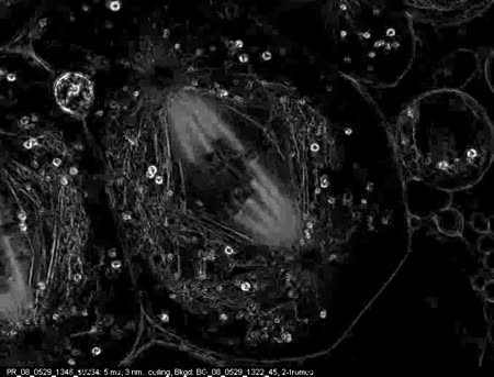 CIL:12027, Nephrotoma, Nephrotoma suturalis, primary spermatocyte