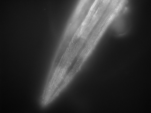 CIL:1106, Caenorhabditis elegans, muscle cell