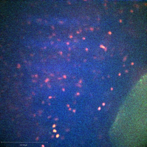 CIL:47316, Staphylococcus aureus, neutrophil, endothelial cell