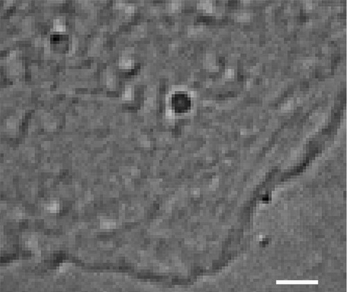 CIL:38597, Homo sapiens, fibroblast