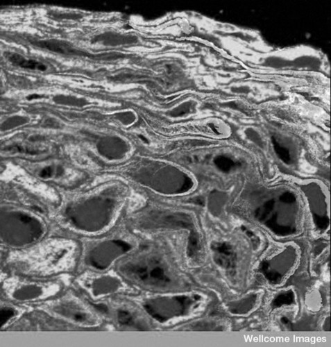 CIL:38804, Homo sapiens, epithelial cell