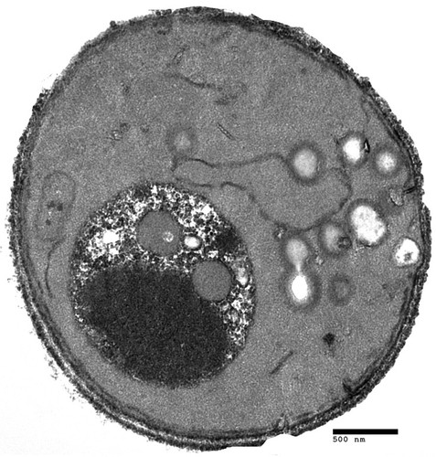 CIL:40415, Saccharomyces cerevisiae, CHC1 mutant