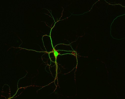 CIL:12442, Rattus, multipolar neuron