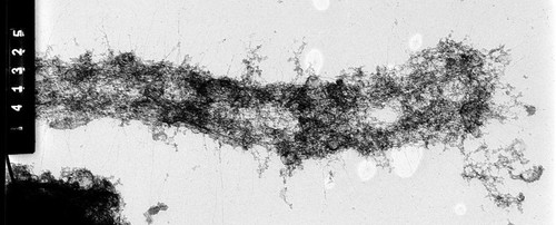 CIL:35376, Homo sapiens, cevical carcinoma