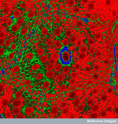 CIL:38968, Homo sapiens, mucin cells