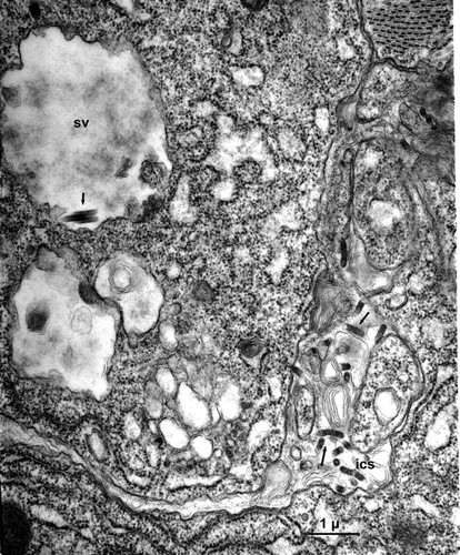 CIL:25377, Maize mosaic virus, Peregrinus maidis, secretory cell