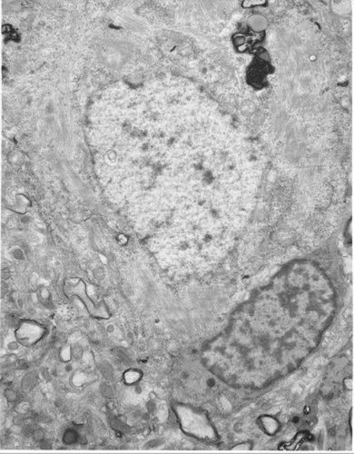 CIL:40191, Homo sapiens, pyramidal cell, neuron of cerebral cortex