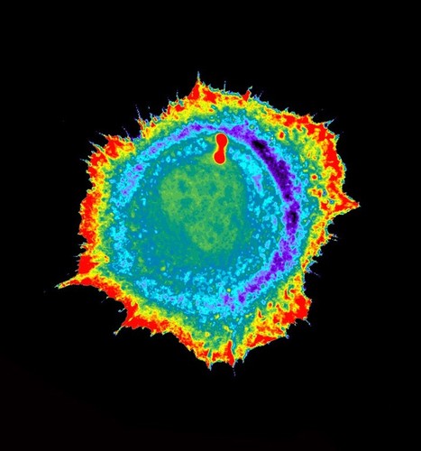 CIL:184, neutrophil