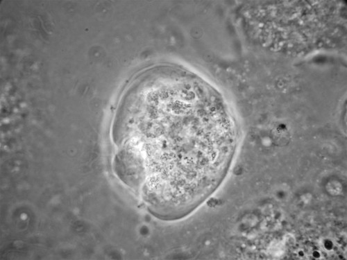 CIL:24577, Balamuthia mandrillaris, cell by organism, eukaryotic cell, Eukaryotic Protist, Amoeboid Protist