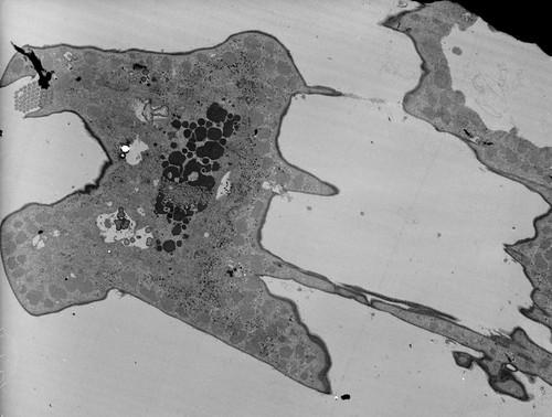 CIL:38868, Euplotes sp., cell by organism, eukaryotic cell, Eukaryotic Protist, Ciliated Protist