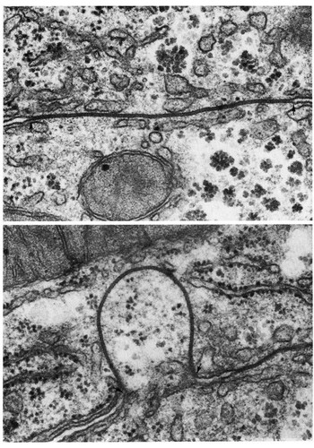 CIL:11235, hepatocyte, epithelial cell