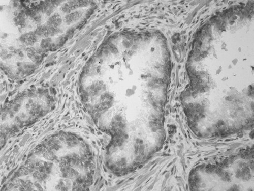 CIL:33598, Homo sapiens, endocrine-paracrine cell of prostate gland, basal cell of prostate epithelium, luminal cell of prostate epithelium, blood vessel endothelial cell, perineural cell, sheath cell, leukocyte, prostate stromal cell, smooth muscle cell of prostate