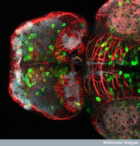 CIL:39025, Danio rerio, neuron