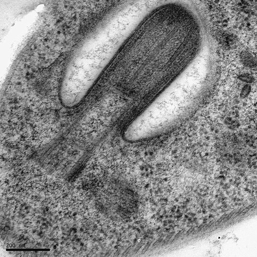 CIL:12595, Trypanosoma brucei, cell by organism, eukaryotic cell, Eukaryotic Protist, Flagellated Protist