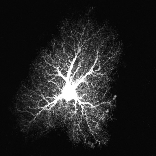 CIL:36370, Rattus norvegicus, astrocyte, astrocyte of the hippocampus