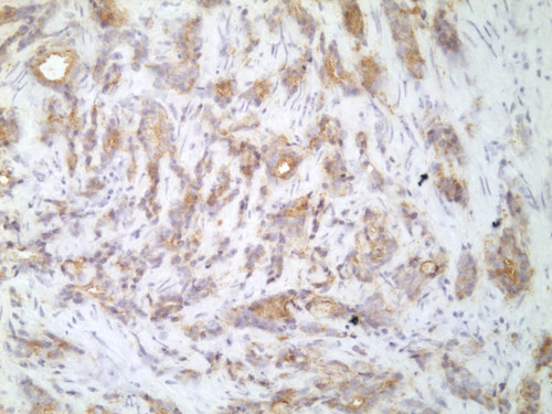CIL:33502, Homo sapiens, endocrine-paracrine cell of prostate gland, basal cell of prostate epithelium, luminal cell of prostate epithelium, blood vessel endothelial cell, perineural cell, sheath cell, leukocyte, prostate stromal cell, smooth muscle cell of prostate