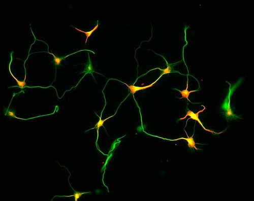 CIL:2903, Rattus, multipolar neuron