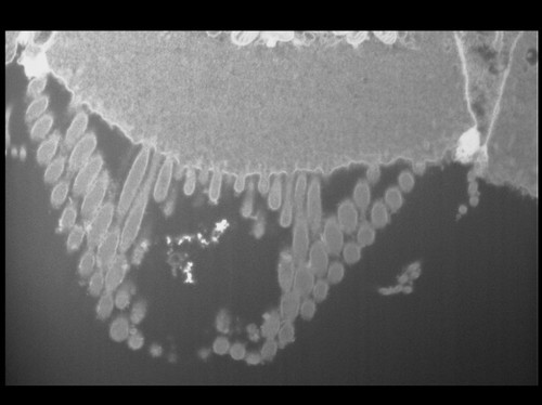 CIL: 50699, FIB-SEM Dataset of anti-PKHD1L1 Immuno-Gold Labeled Outer Hair Cell Stereocilia Bundles: 3.3_Cell_3_Stack_Filtered