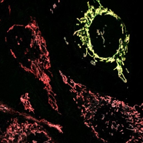 CIL:13734, Homo sapiens, endothelial cell