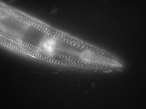 CIL:1125, Caenorhabditis elegans, muscle cell