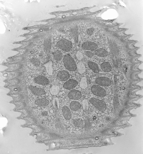 CIL:39464, Vorticella convallaria, cell by organism, eukaryotic cell, Eukaryotic Protist, Ciliated Protist