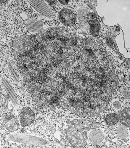 CIL:39204, Paramecium caudatum, cell by organism, eukaryotic cell, Eukaryotic Protist, Ciliated Protist