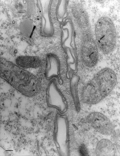 CIL:13134, Paramecium multimicronucleatum, cell by organism, eukaryotic cell, Eukaryotic Protist, Ciliated Protist