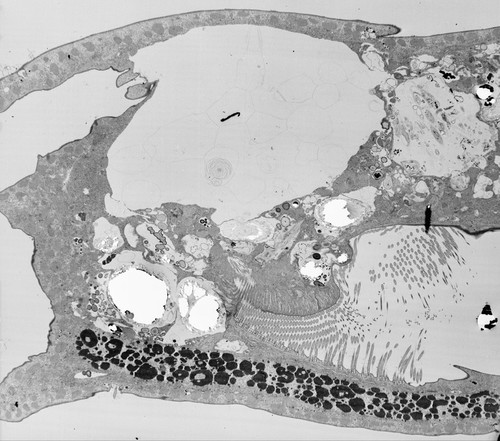 CIL:38867, Euplotes sp., cell by organism, eukaryotic cell, Eukaryotic Protist, Ciliated Protist