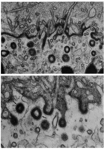 CIL:11164, Periplaneta americana, oocyte