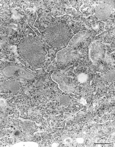 CIL:36770, Paramecium caudatum, cell by organism, eukaryotic cell, Eukaryotic Protist, Ciliated Protist