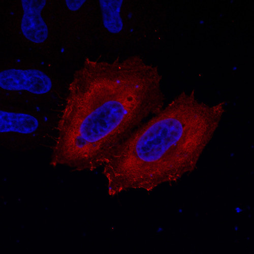 CIL: 53682, Homo sapiens, HeLa