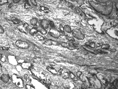 CIL:34069, Homo sapiens, endocrine-paracrine cell of prostate gland, basal cell of prostate epithelium, luminal cell of prostate epithelium, blood vessel endothelial cell, perineural cell, sheath cell, leukocyte, prostate stromal cell, smooth muscle cell of prostate