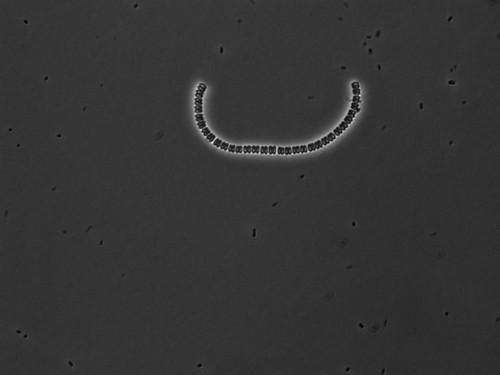 CIL: 54819, Alysiella filiformis, bacteria