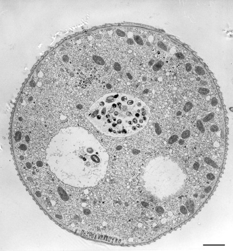 CIL:36245, Vorticella convallaria, cell by organism, eukaryotic cell, Eukaryotic Protist, Ciliated Protist