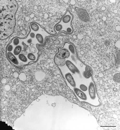 CIL:36276, Vorticella convallaria, cell by organism, eukaryotic cell, Eukaryotic Protist, Ciliated Protist