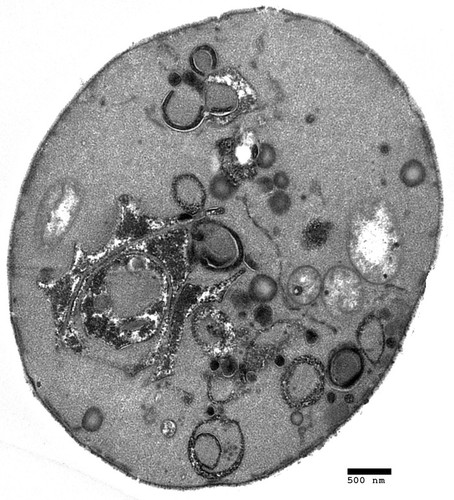 CIL:40411, Saccharomyces cerevisiae, ARF1 mutant