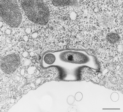 CIL:36277, Vorticella convallaria, cell by organism, eukaryotic cell, Eukaryotic Protist, Ciliated Protist