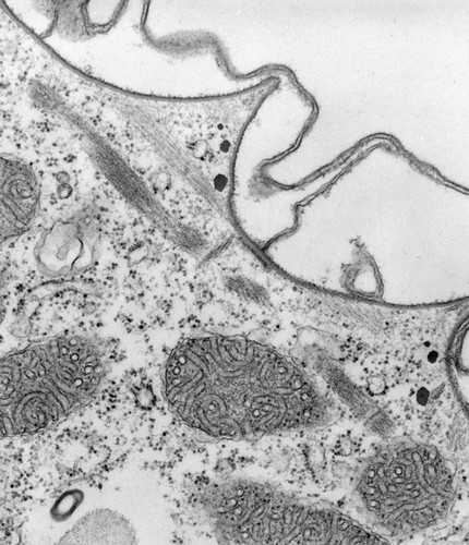 CIL:39312, Paramecium multimicronucleatum, cell by organism, eukaryotic cell, Eukaryotic Protist, Ciliated Protist