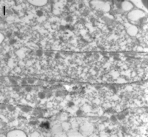 CIL:9848, Paramecium tetraurelia, cell by organism, eukaryotic cell, Eukaryotic Protist, Ciliated Protist