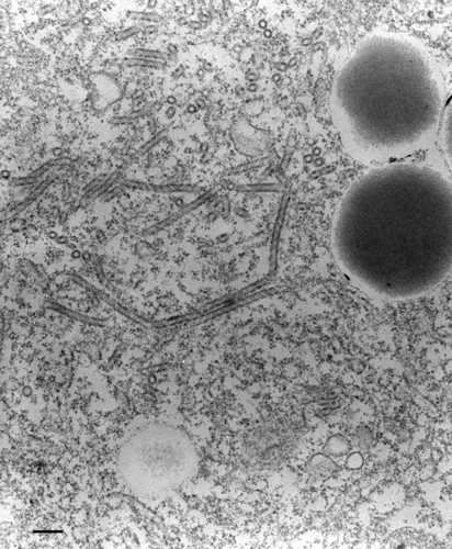 CIL:20815, Paramecium multimicronucleatum, cell by organism, eukaryotic cell, Eukaryotic Protist, Ciliated Protist