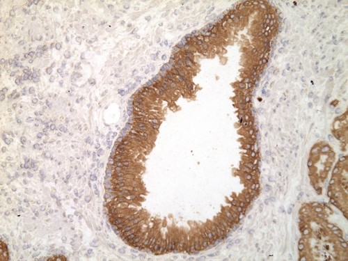 CIL:34265, Homo sapiens, endocrine-paracrine cell of prostate gland, basal cell of prostate epithelium, luminal cell of prostate epithelium, blood vessel endothelial cell, perineural cell, sheath cell, leukocyte, prostate stromal cell, smooth muscle cell of prostate