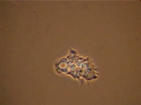 CIL:19326, Acanthamoeba castellanii, cell by organism, eukaryotic cell, Eukaryotic Protist, Amoeboid Protist