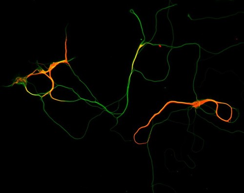 CIL:3074, Rattus, multipolar neuron