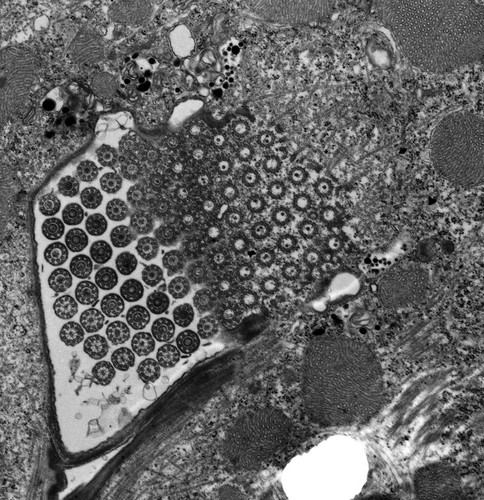 CIL:9806, Euplotes sp., cell by organism, eukaryotic cell, Eukaryotic Protist, Ciliated Protist