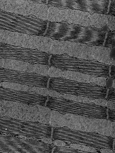 CIL:36118, damselfly, flight muscle cell